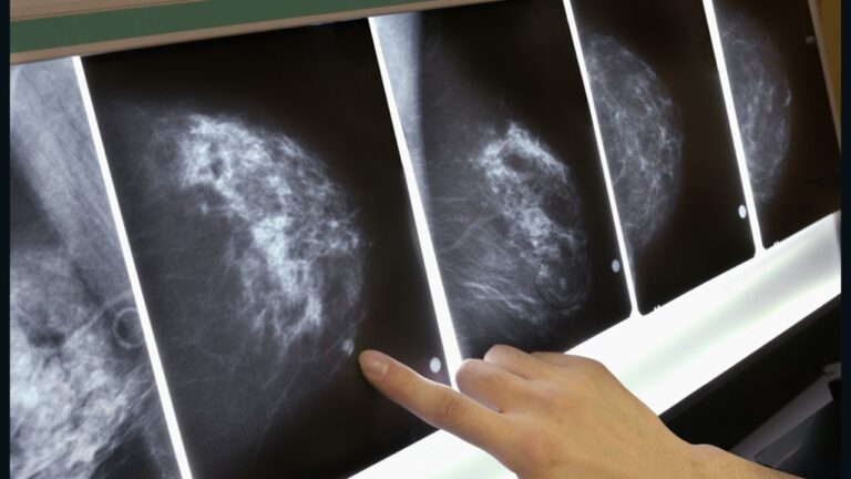 Chemicals linked to breast cancer leach into our foods, study finds